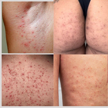 Sabonete Clareador - Compre 1 e Leve 4