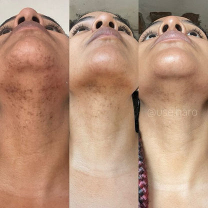 Sabonete Clareador - Compre 1 e Leve 4