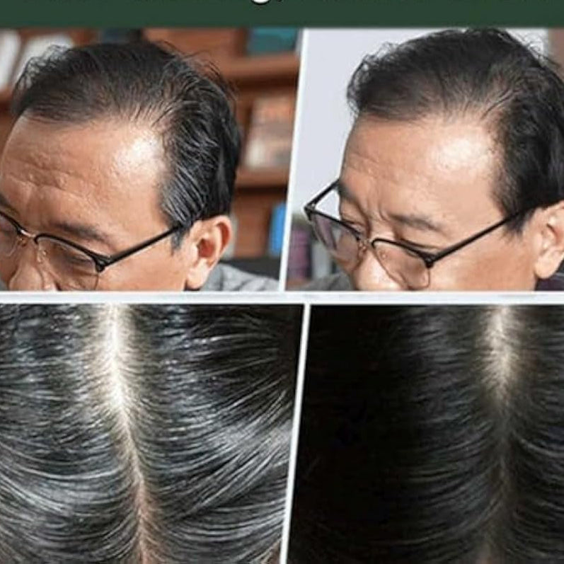 Pente Raiz Branca - Compre 1 e Leve 2