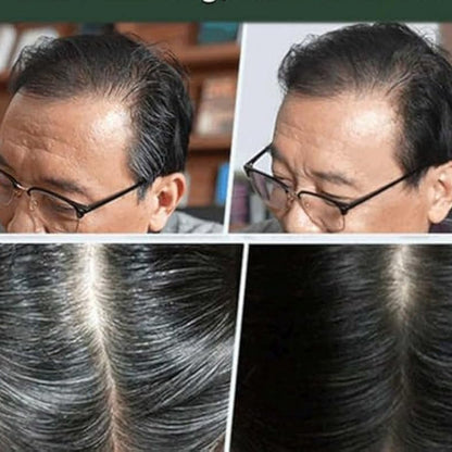 Pente Raiz Branca - Compre 1 e Leve 2