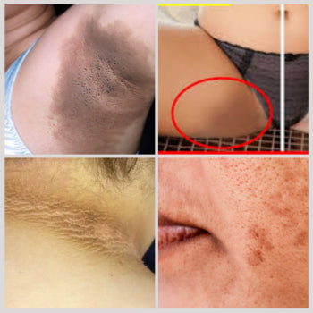 Sabonete Clareador - Compre 1 e Leve 4